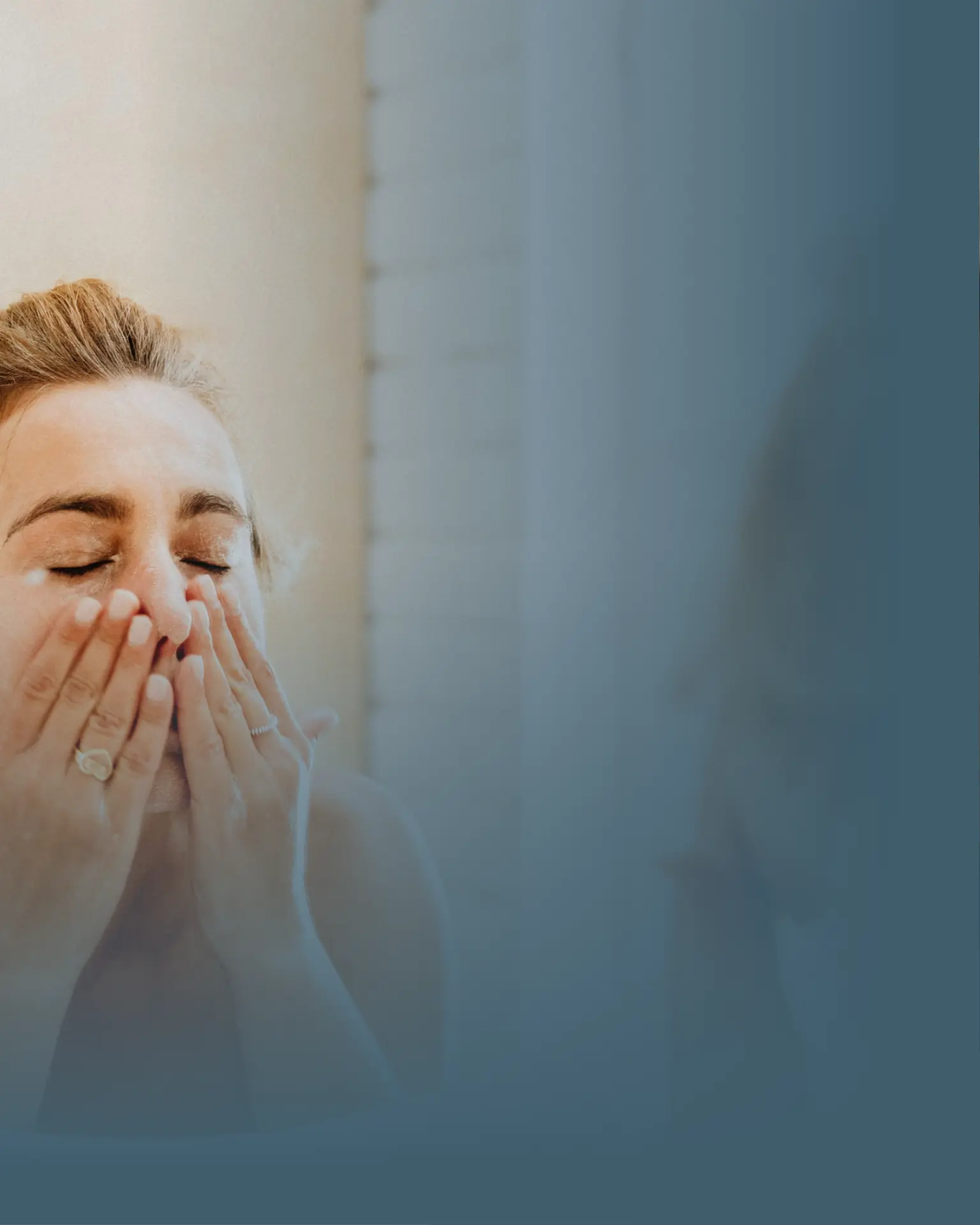 Paralisia Facial