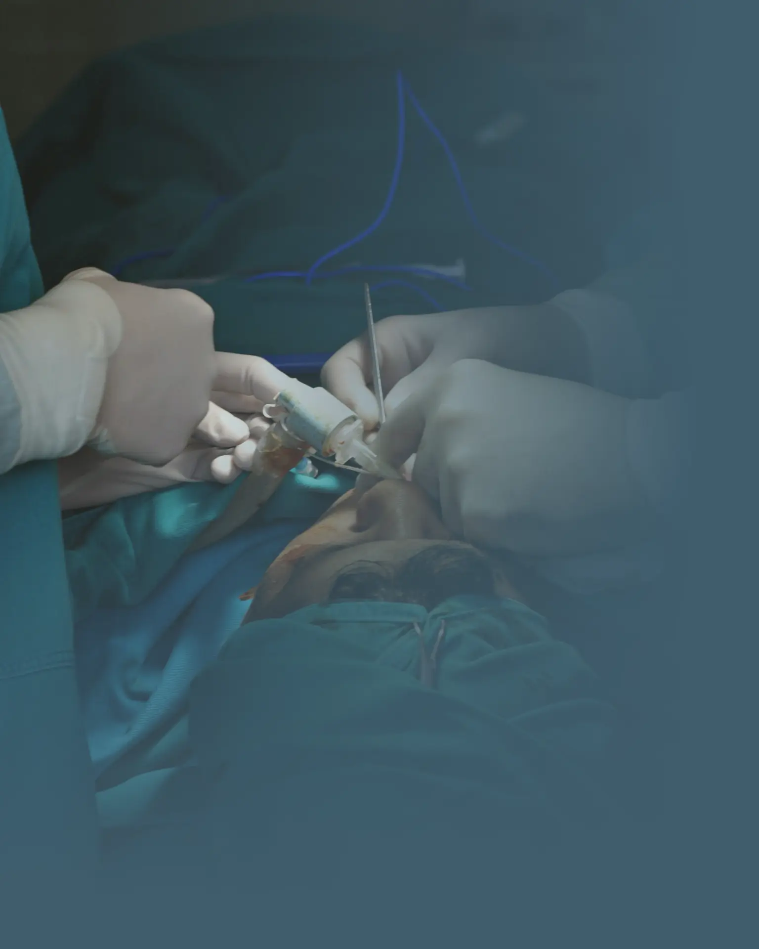 Pós-operatório de Cirurgias de Cabeça e Pescoço